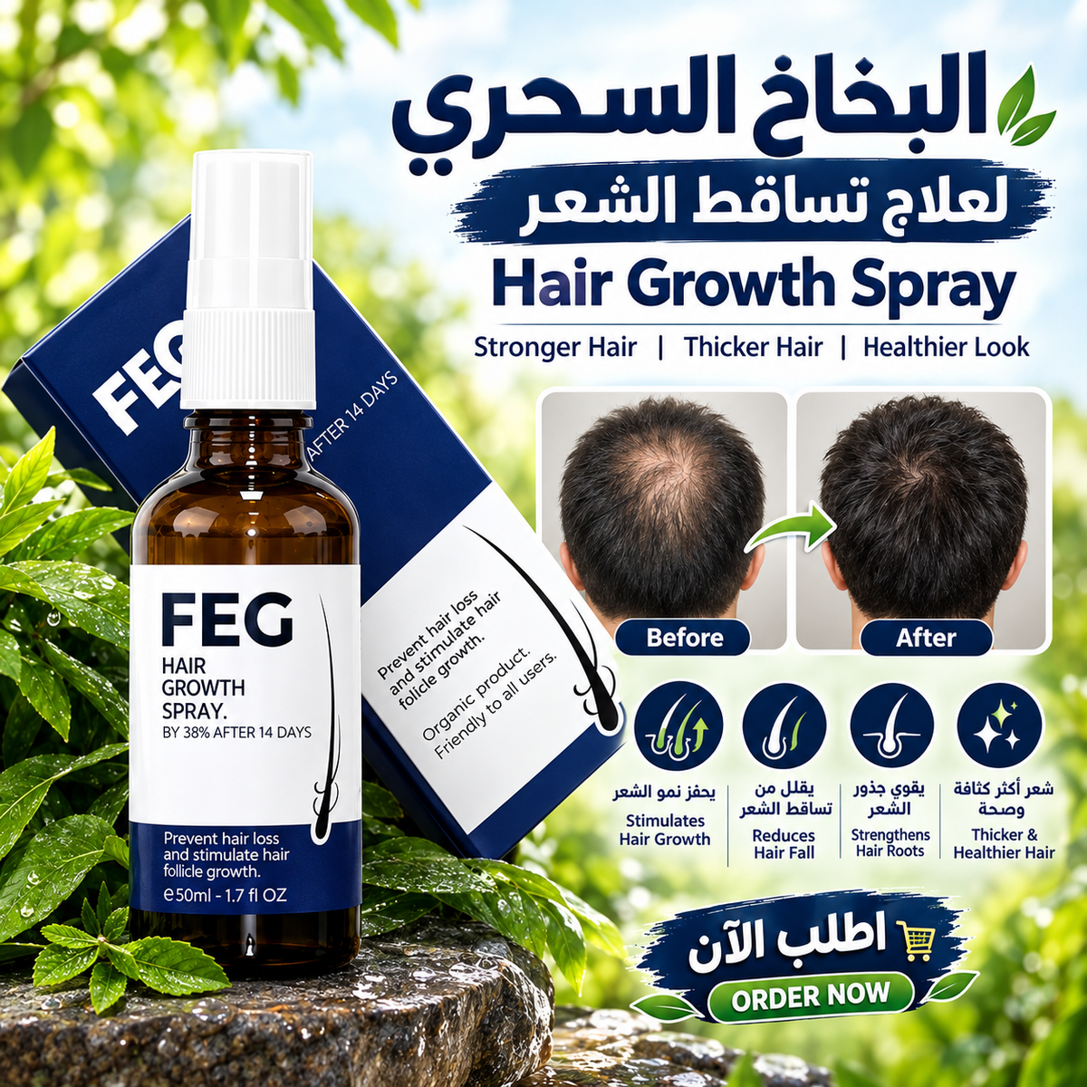 FEG Plus Hair Growth Spray | بخاخ نمو الشعر وتقويته 💆‍♂️🌿